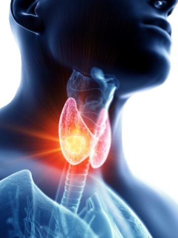 Pathologie Thyroïdienne – Module 2 : l’Hypothyroïdie - Intégrer les recommandations dans la pratique